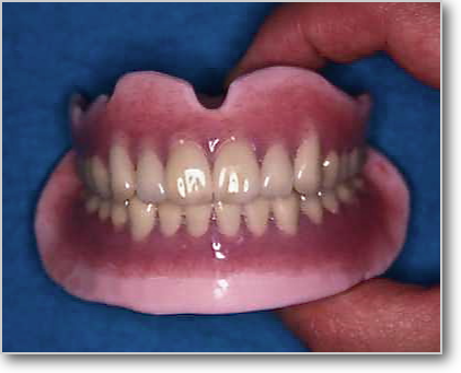 ヨコタデンチャー・治療用義歯